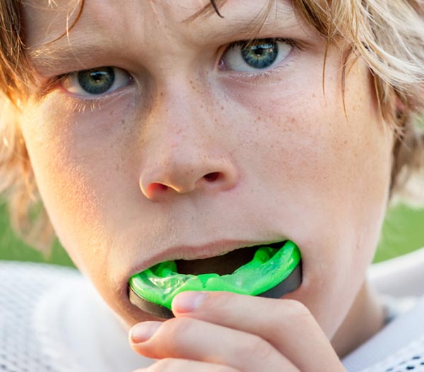 mouth guards