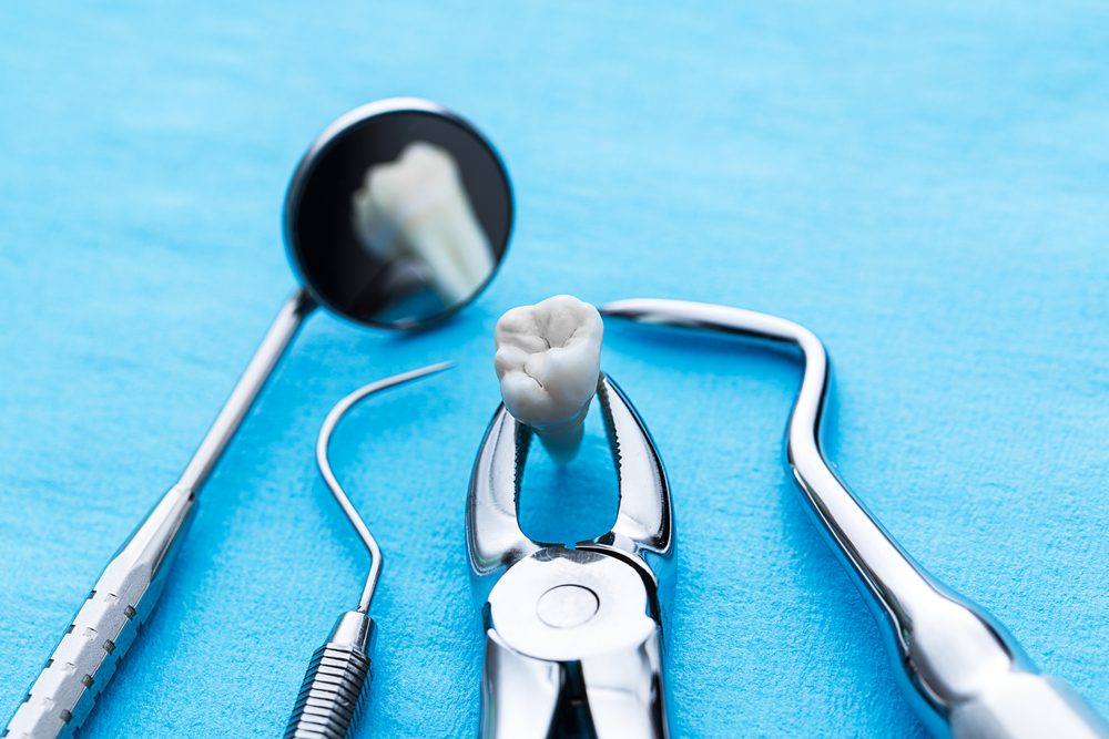 what to do after tooth extraction