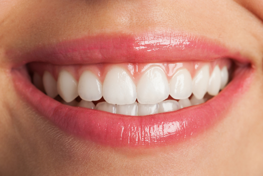 Brighten your smile with professional Teeth Whitening in Yellowknife. Our experienced dentist in Yellowknife offers safe, effective treatments to enhance your confidence